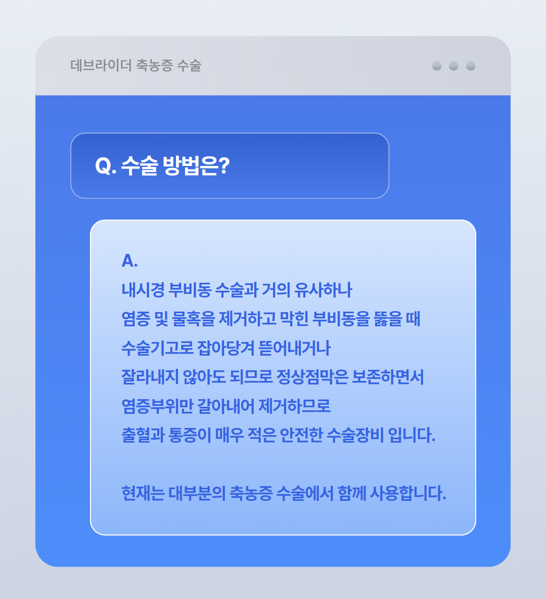 코 수술 안내 Q&A (6).png